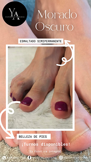 Ya_estetica_en_La_Guia_Esquel