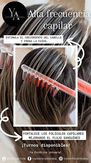 Ya_estetica_en_La_Guia_Esquel