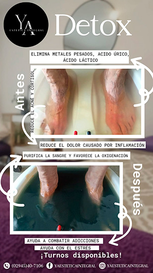 Ya_estetica_en_La_Guia_Esquel