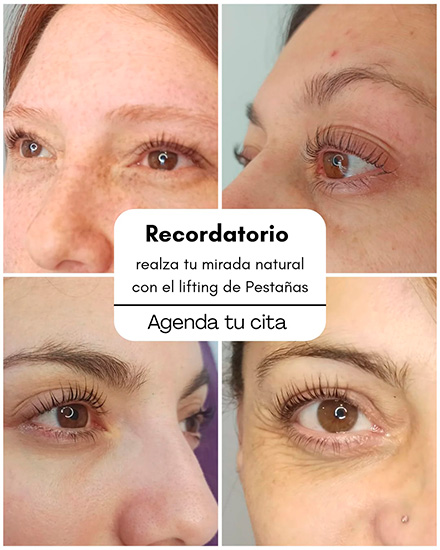 Ya_estetica_en_La_Guia_Esquel