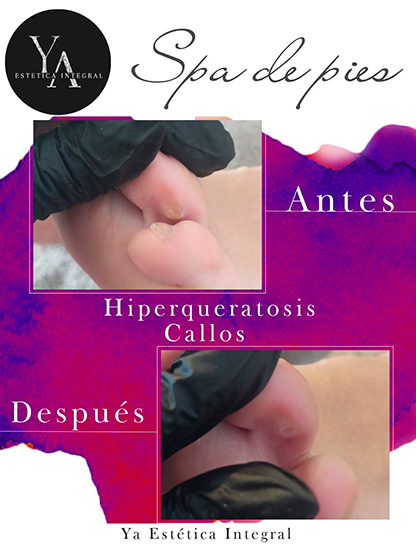 Ya_estetica_en_La_Guia_Esquel