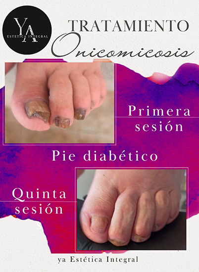 Ya_estetica_en_La_Guia_Esquel