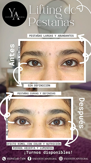 Ya_estetica_en_La_Guia_Esquel_7