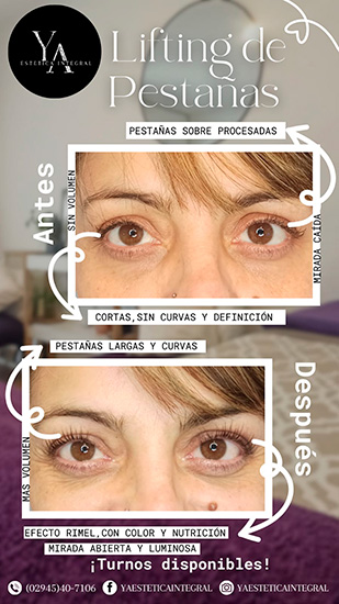 Ya_estetica_en_La_Guia_Esquel