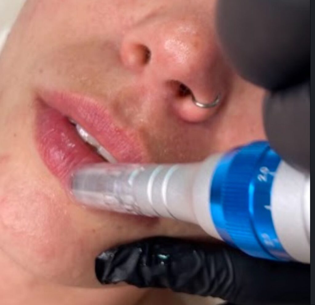 Cosmiatría Concienca en_La_Guia_Esquel