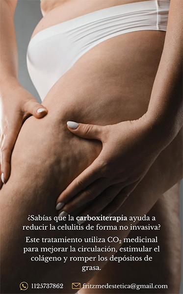 Dra_Giuliana_Fritz_en_La_Guia_Esquel_