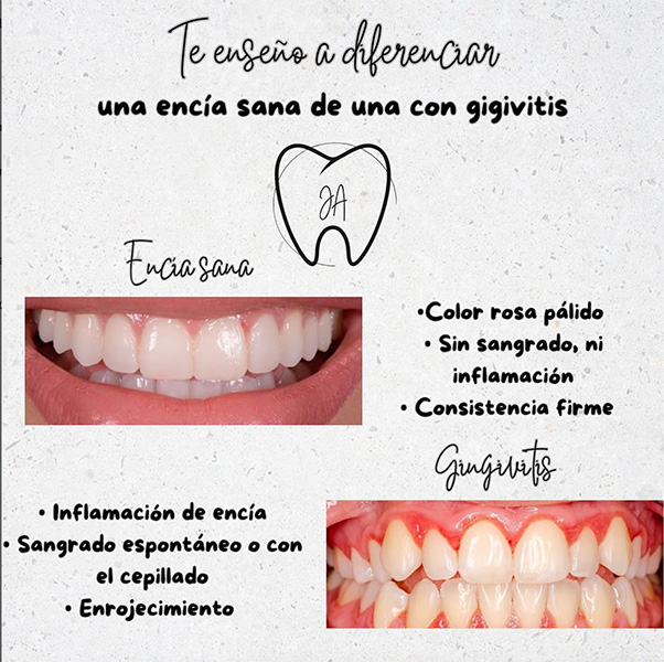 Jenifer_Ataide_odontologa_en_la_guia_esquel_5